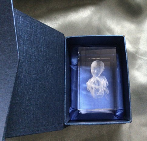 foetus in cadeau doos